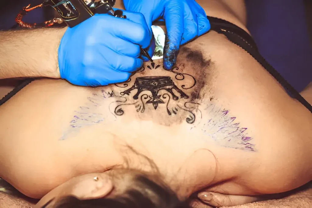 Salabrasion Tattoo Removal